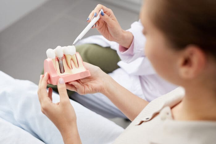 Are Dental Implants For Me?